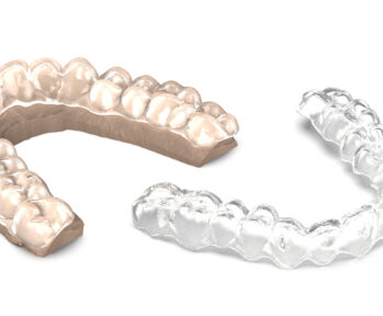 SprintRay-3dprinter-Aligners-Essix-retainers-fabricate-dental-dentist
